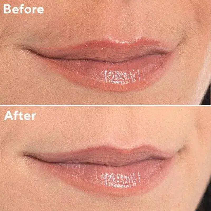 Aurea Trim™ - Aurea