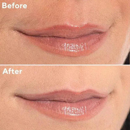 Aurea Trim™ - Aurea